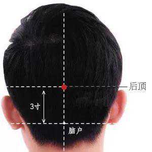 每日一穴：后顶穴